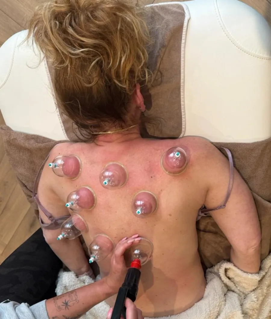 Cupping massage